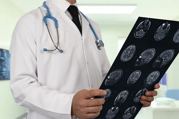 علائم سکته مغزی مخچه شامل سرگیجه و اختلال تعادل