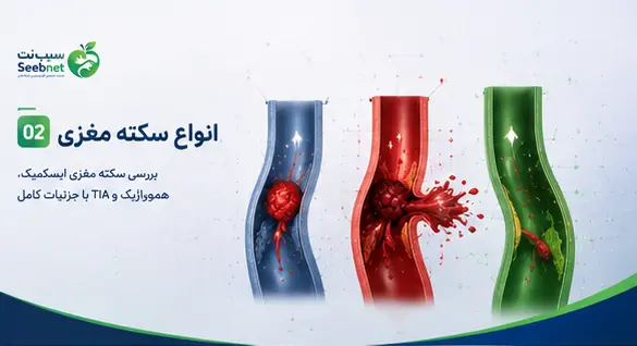 انواع سکته مغزی